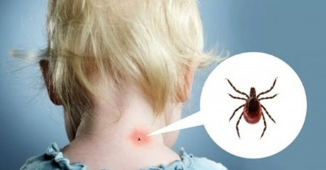 от укуса клещей можно тоже пострадать - фото - 1